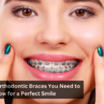 5 Types of Orthodontic Braces You Need to Know for a Perfect Smile