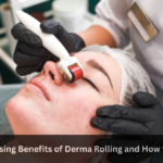 5 Surprising Benefits of Derma Rolling and How to Use it